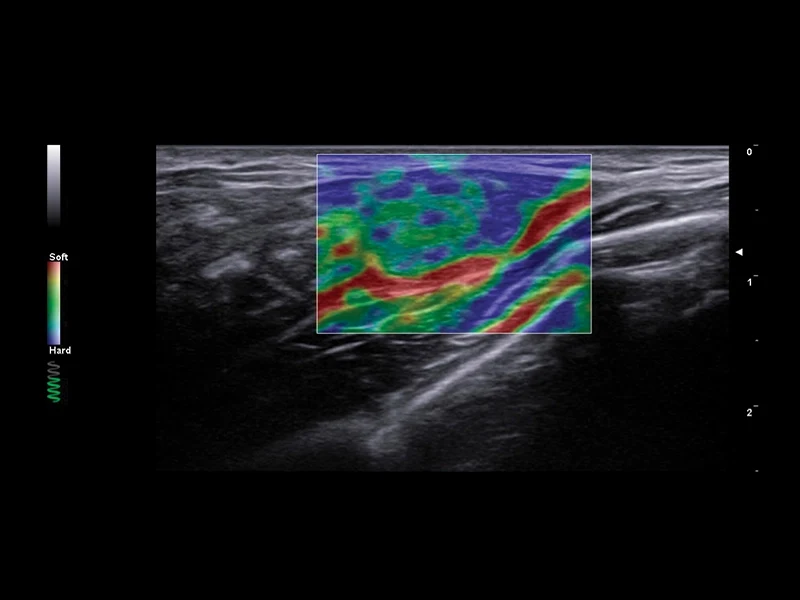 MyLab™A50 - ElaXto elastography