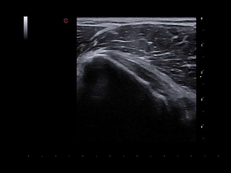 MyLab™A50 - musculoskeletal