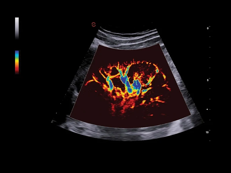 MyLab™A50 - microV, kidney