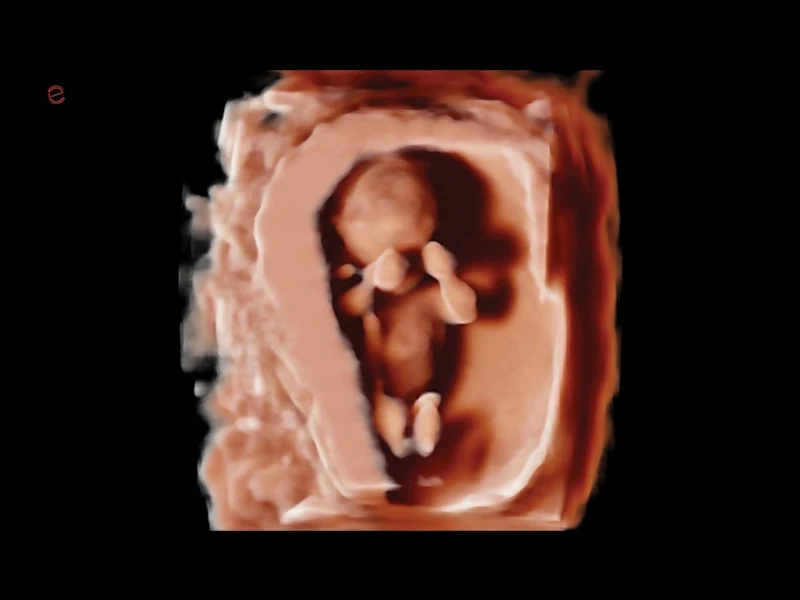 MyLab™A70 - 3D/4D imaging