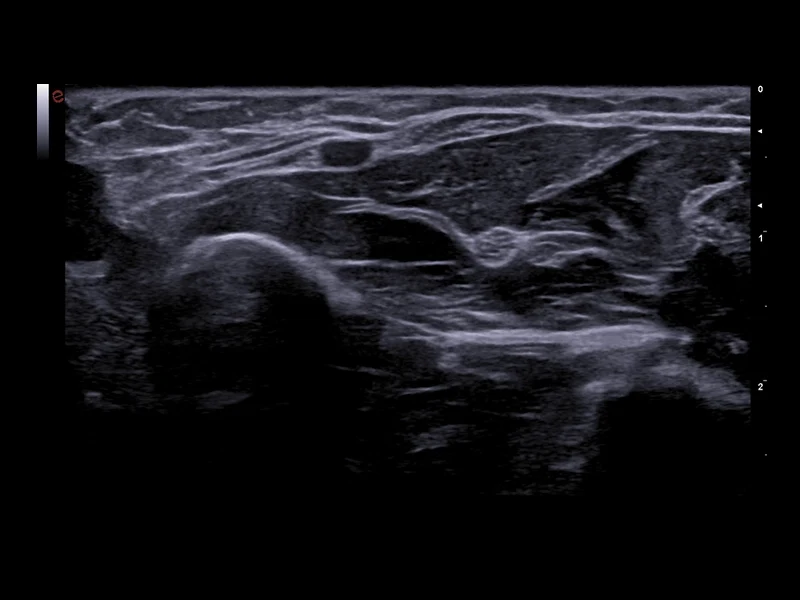 MyLab™A70 - musculoskeletal