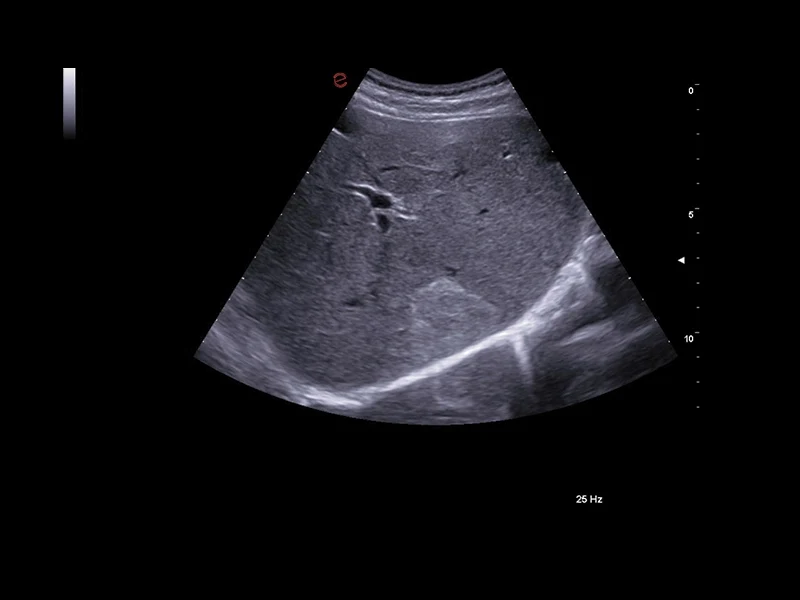 MyLab™A70 - liver pathology