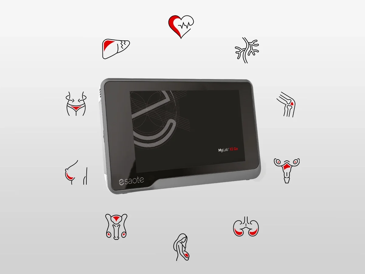 Esaote MyLab™X1 GO