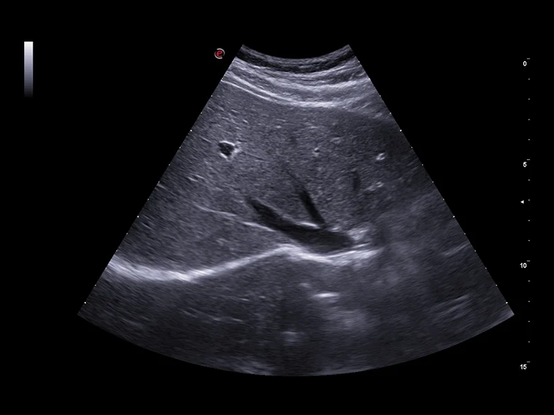 Liver care clinical image