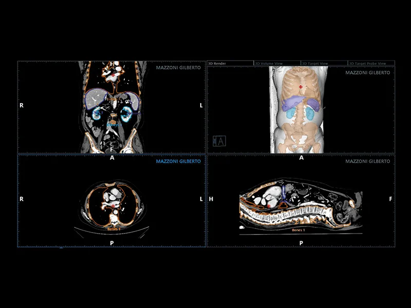 Liver care clinical image