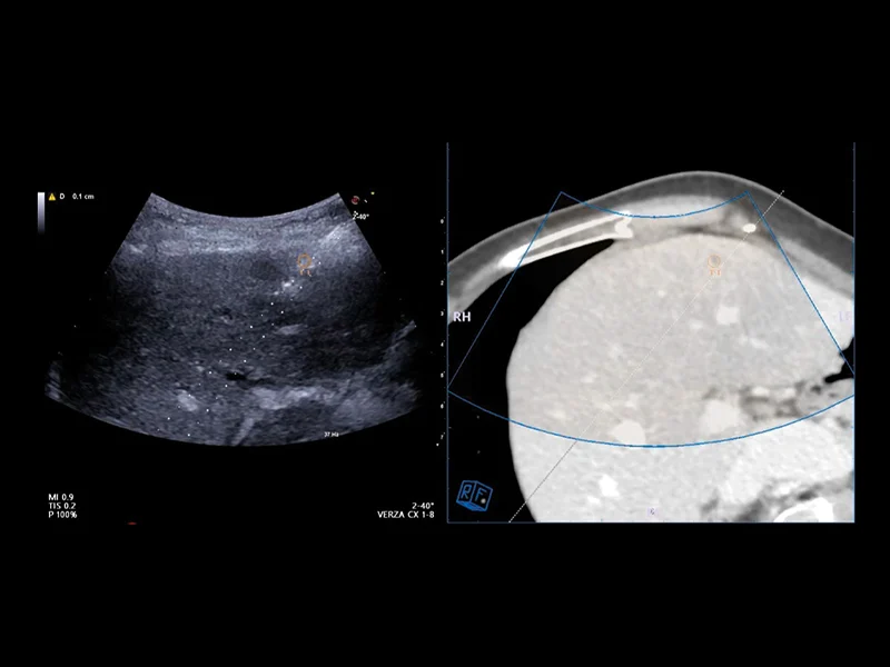 Liver care clinical image