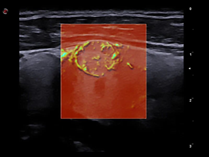 Musculoskeletal Clinical Images