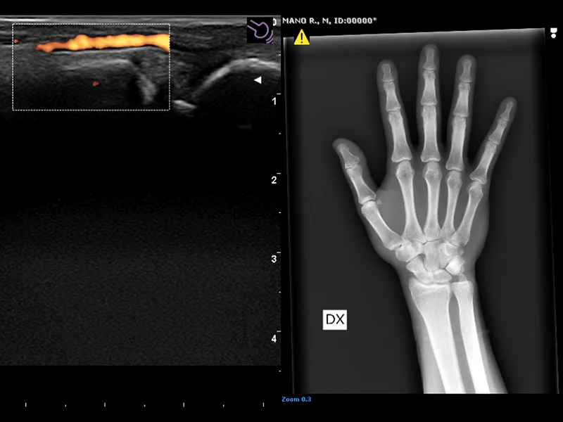 Musculoskeletal Clinical Images