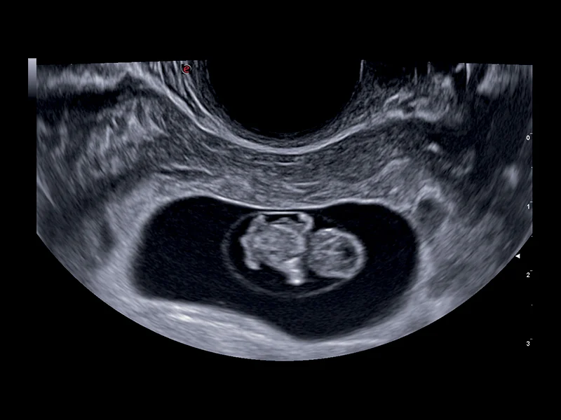 Obstetrics clinical image