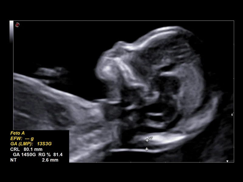 Obstetrics clinical image