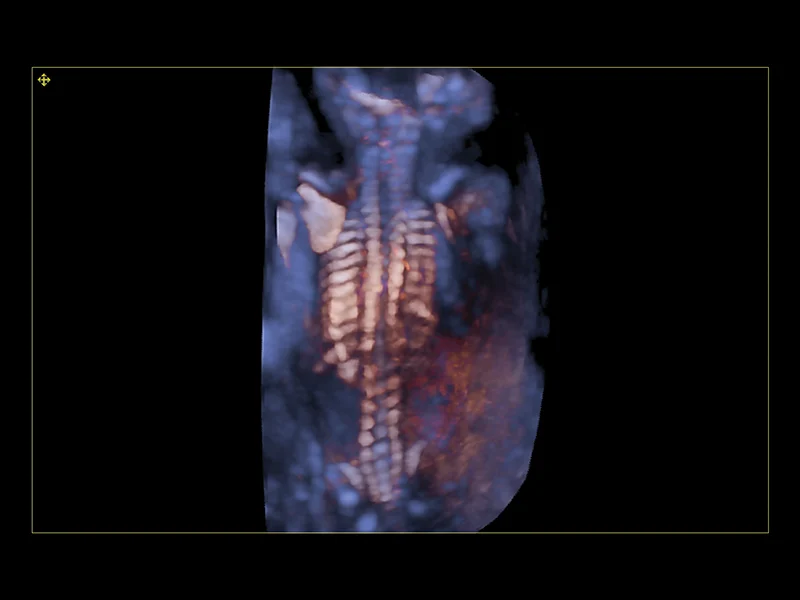 Obstetrics clinical image