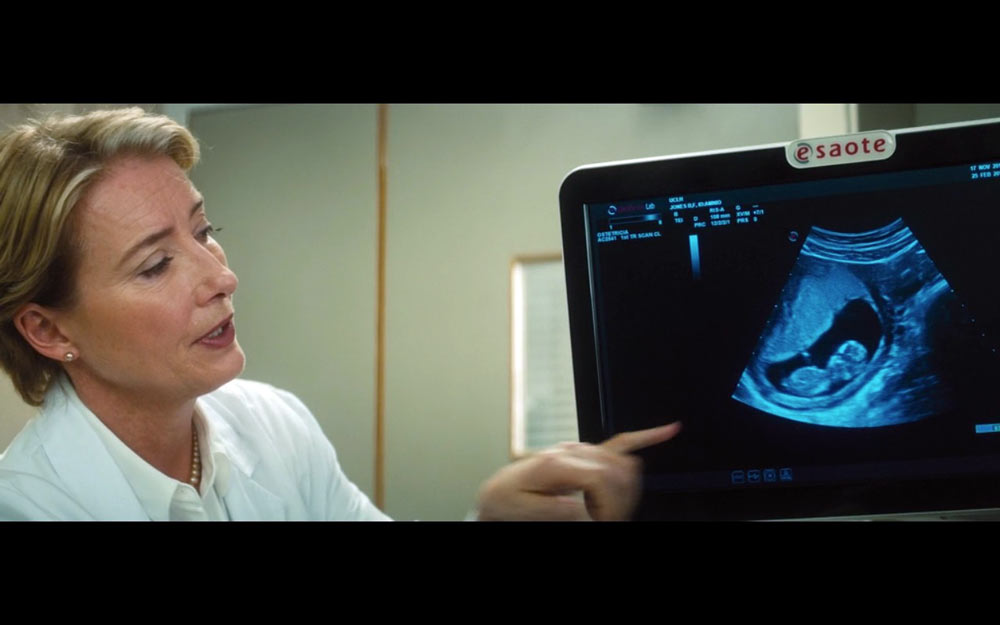 zakup ultrasonografu